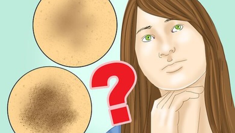 How to Prevent Hyperpigmentation of the Skin
