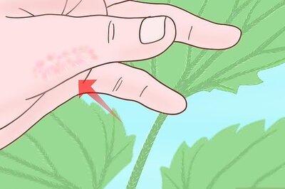 How to Touch Nettles Without Stinging Yourself