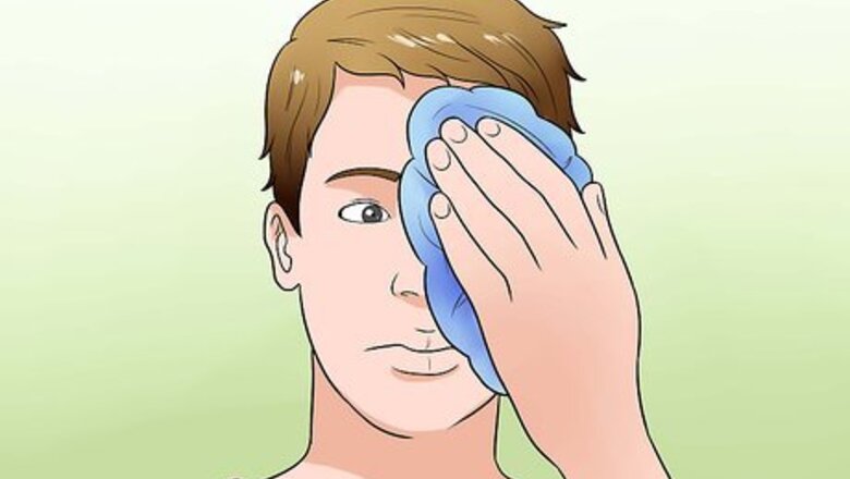 How to Treat a Black Eye