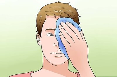 How to Treat a Black Eye